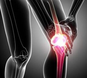 knee pain in arthritis and osteoarthritis