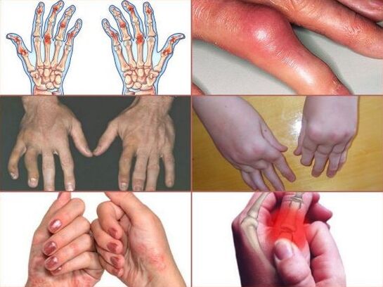 finger joint pain
